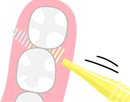 歯間ブラシ